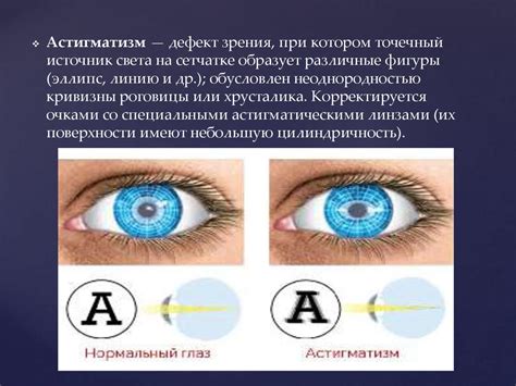 Адаптация глаз к темноте: организация работы зрительной системы