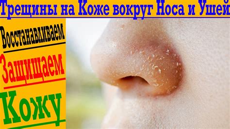Альтернативные способы распарки кожи на носу