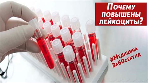 Анализы для обнаружения хламидий у ребенка