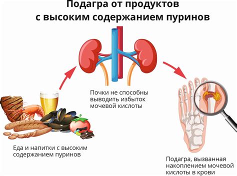 Апельсины и подагра: подробное рассмотрение исследований