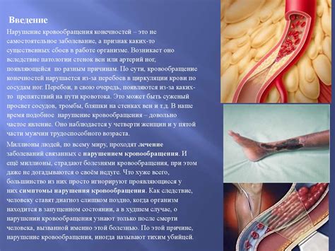 Артериальная гипертензия и нарушения кровообращения