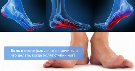 Асимметричные нагрузки на организм: причина, почему левая нога толще правой