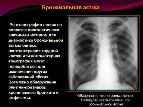 Астма и обструктивные болезни легких