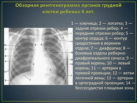Безопасность процедуры рентгена легких у детей