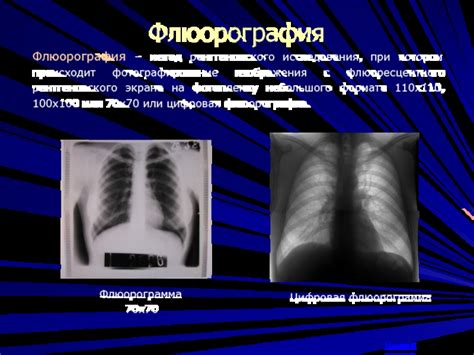 Безопасность рентгеновского исследования при болезни