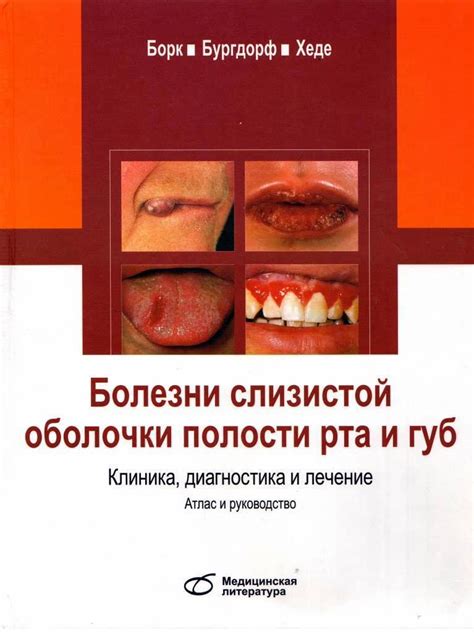 Болезни губ и полости рта