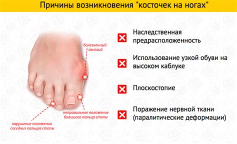 Боли в пальцах ног при грибковых инфекциях