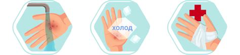 Быстрое лечение и первая помощь при ожоге