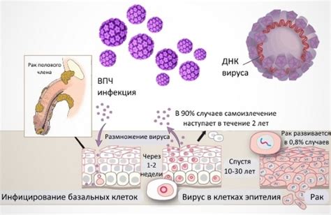 ВПЧ у мужчин: важные аспекты для общественного здравоохранения