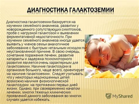 Важность диеты при галактоземии