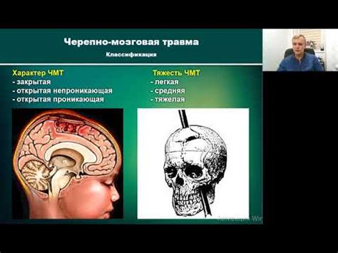 Важность и роль определения ЧМТ у стрижа