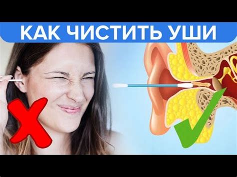 Важные моменты и противопоказания для ставки ушей