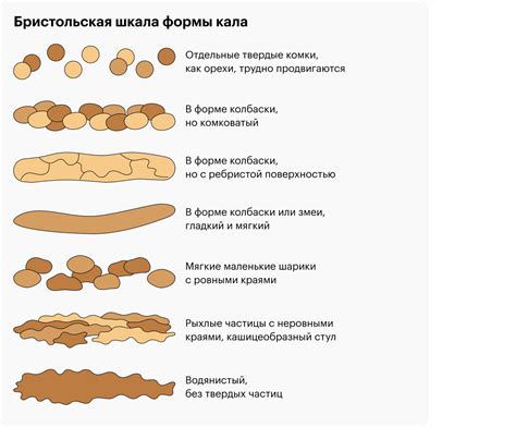 Виды пиццепечей