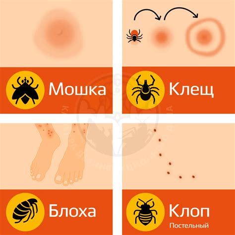 Виды реакций на укус мошки и их особенности