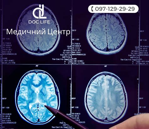 Визуальные методы диагностики аневризм головного мозга