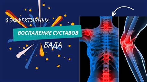 Вирусные инфекции как причина воспаления суставов