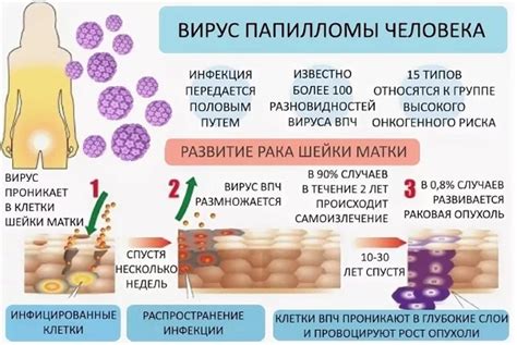 Вирус папилломы человека: основные причины у мужчин
