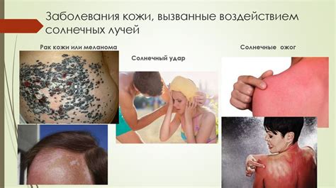 Влияние Финалгона на кожу