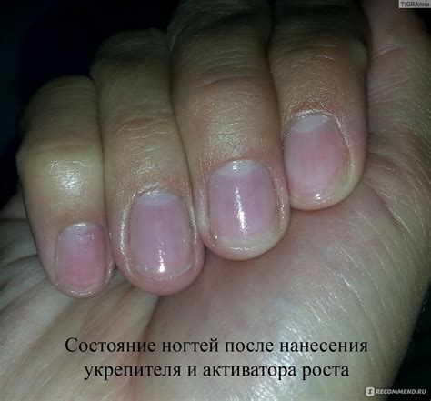 Влияние гель-лака на состояние ногтей