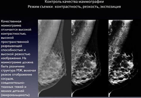 Влияние дезодорантов на результаты маммографии