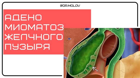 Влияние зеленого чая на профилактику пропуска желчного пузыря