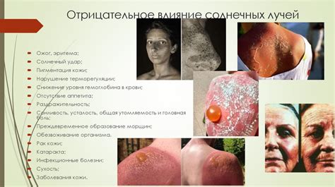 Влияние йода на кожу