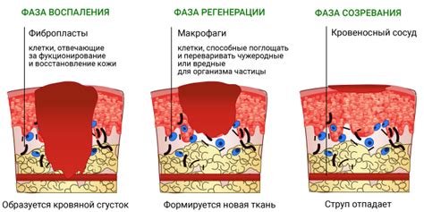 Влияние места и размера ожога на исцеление