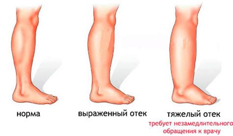 Влияние неодинаковой нагрузки на ноги