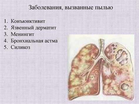 Влияние пыли на здоровье