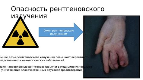 Влияние рентгеновского излучения