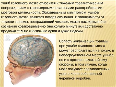 Влияние рентгеновского исследования на диагностику сотрясения головного мозга