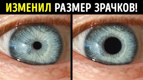 Влияние сна и отдыха на размер зрачков глаз