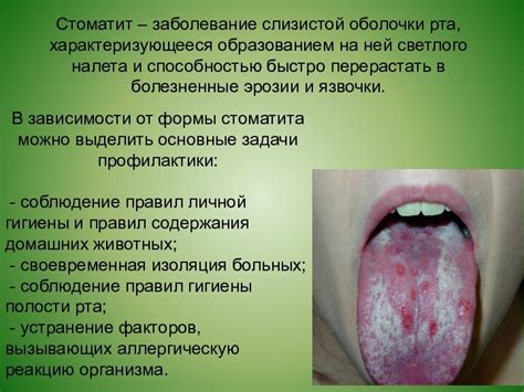 Влияние стоматита на здоровье детей и способы его лечения