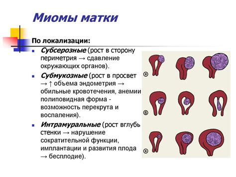 Влияние физиопроцедур на размеры миомы