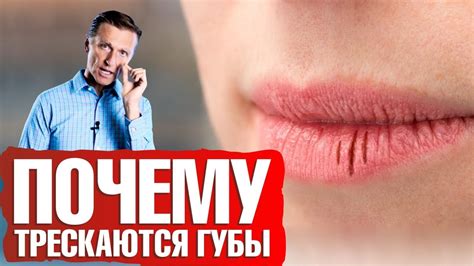 Внешние факторы, вызывающие сухость губ
