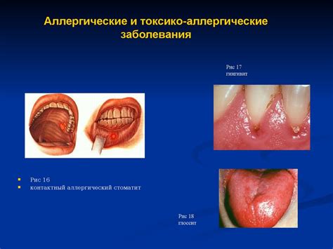 Возможное раздражение слизистой оболочки