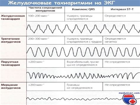 Возможность развития сердечных аритмий