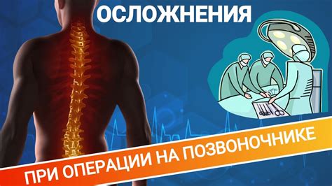 Возможные осложнения операции на позвоночник