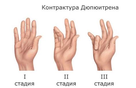 Возможные патологии, влияющие на форму пальцев