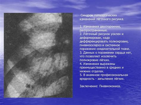 Возможные последствия при сильном притеснении рисунка
