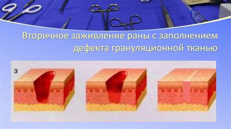 Возможные последствия раны с выделениями