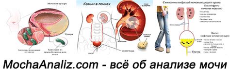Возможные причины мутности мочи