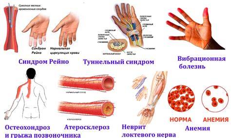 Возможные причины онемения правой руки