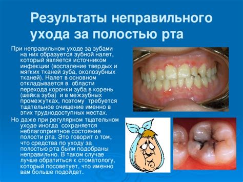Возможные проблемы с зубами и полостью рта