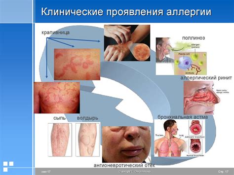 Возможные проявления аллергии