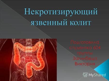 Воспаление слизистой оболочки толстой кишки