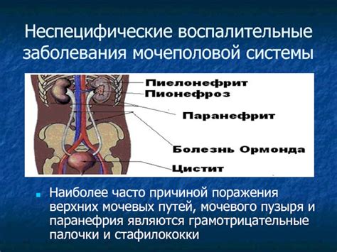 Воспалительные заболевания мочевого пузыря: