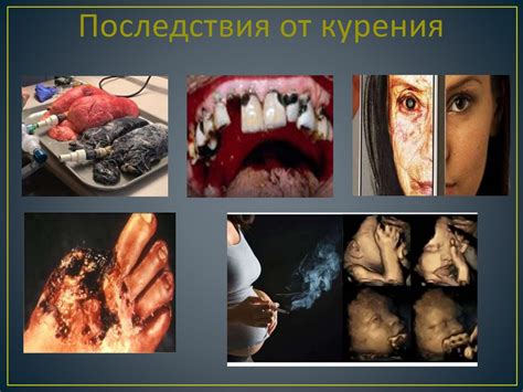 Вредные привычки и их влияние на жжение в области щек