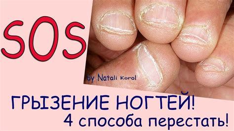 Вредные привычки как фактор тонких ног