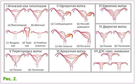 Врожденные аномалии развития: